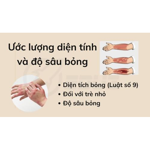 2. Ước lượng diện tích và độ sâu bỏng